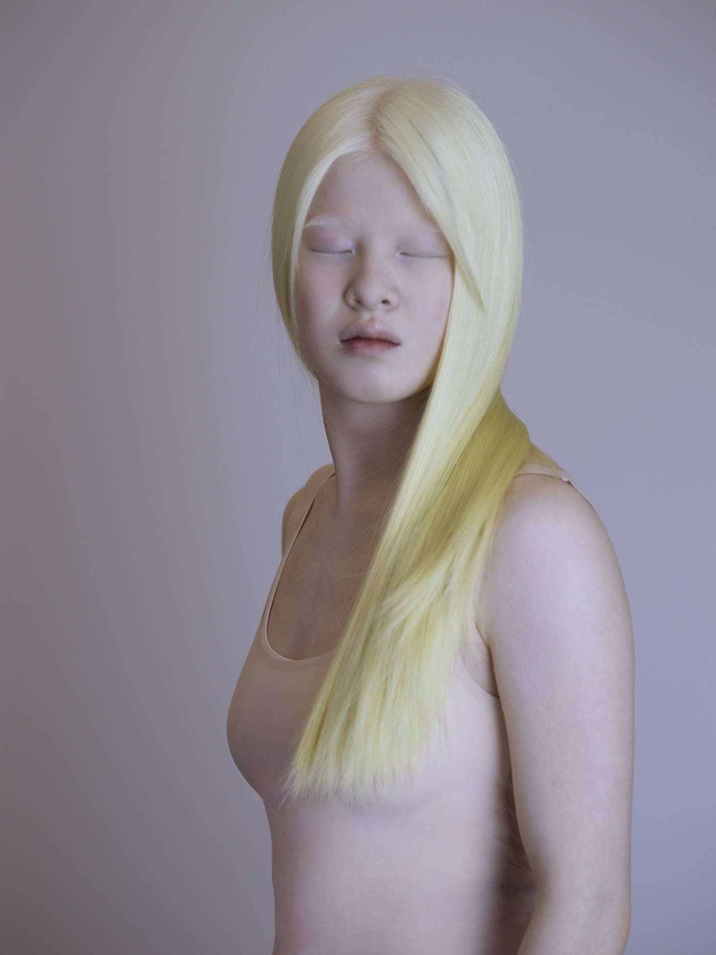 Albino Girl Naked