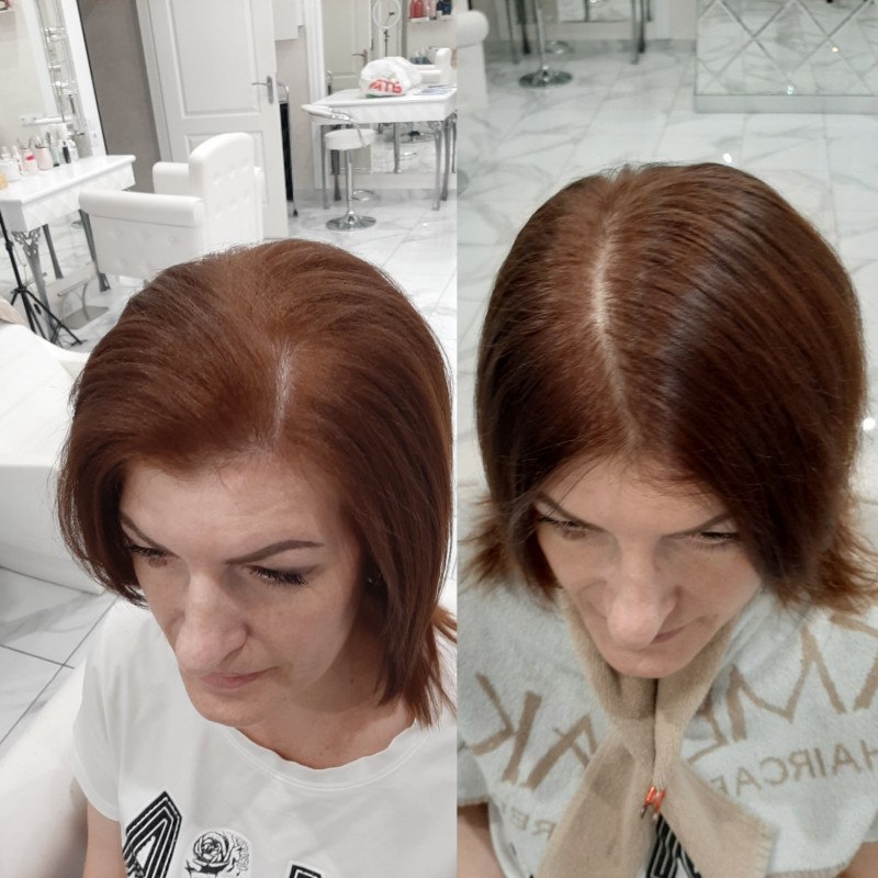 Thin hair before and after corrugation