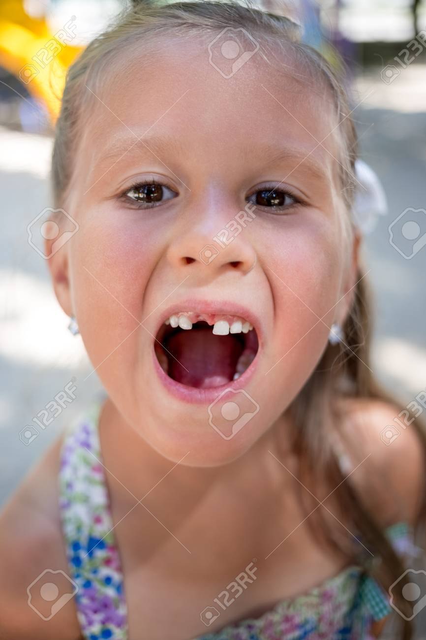 Girl Teen without a tooth