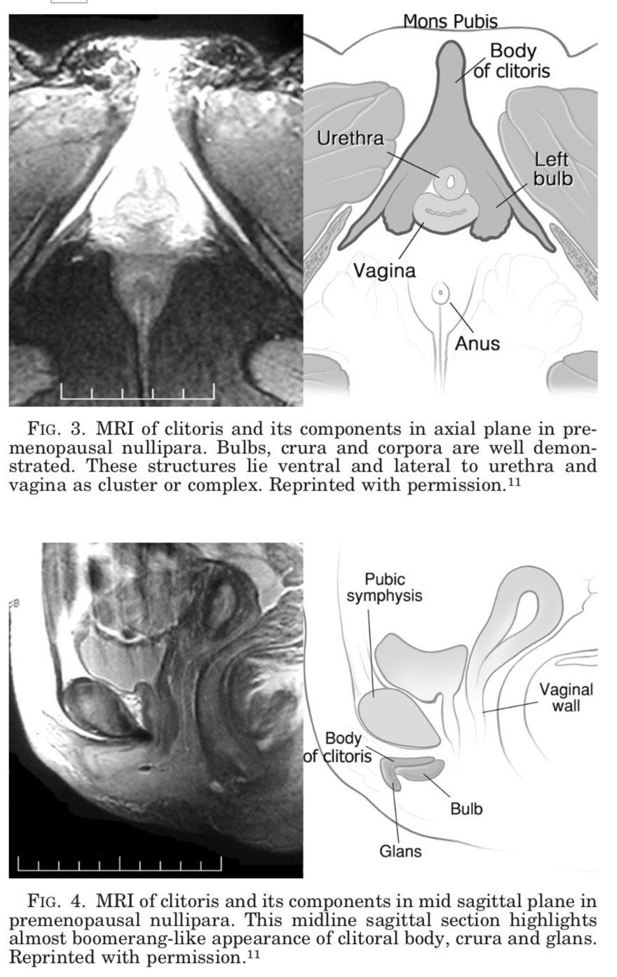 The clitoris is completely