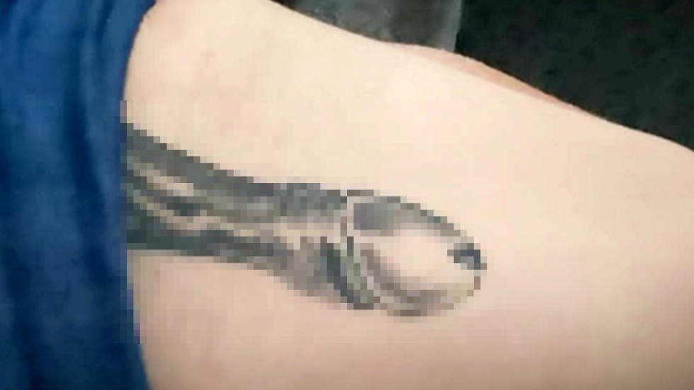 Dismemberment of a member of a dick