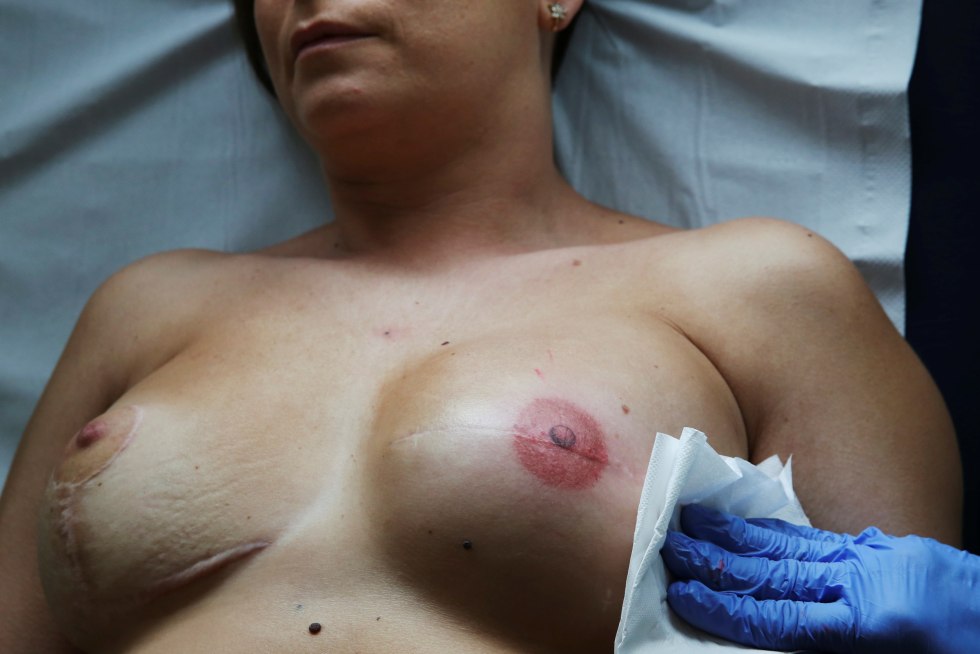 Naked female breast accident