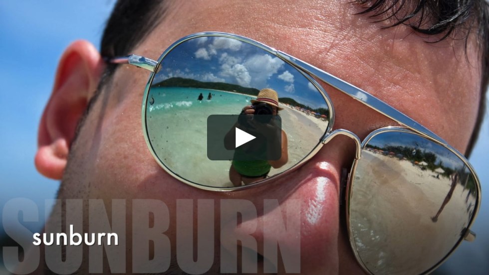 Amber Herd with glasses for vision