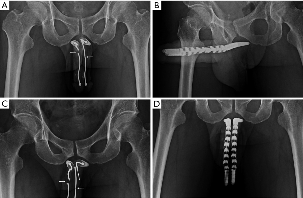 Member in a calm state