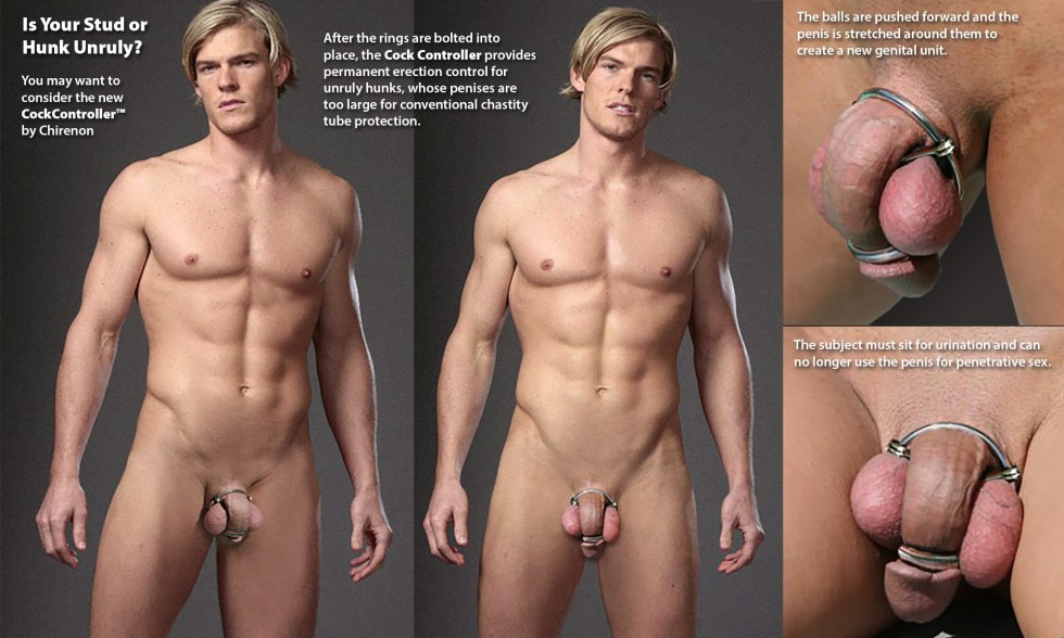 Gay Chastity reduction of the penis before and after