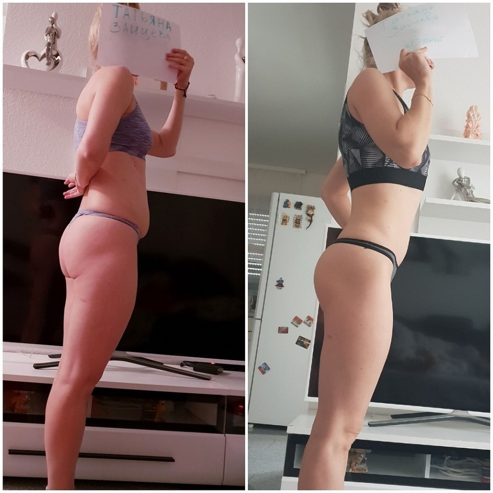 The girl's stomach is bulging