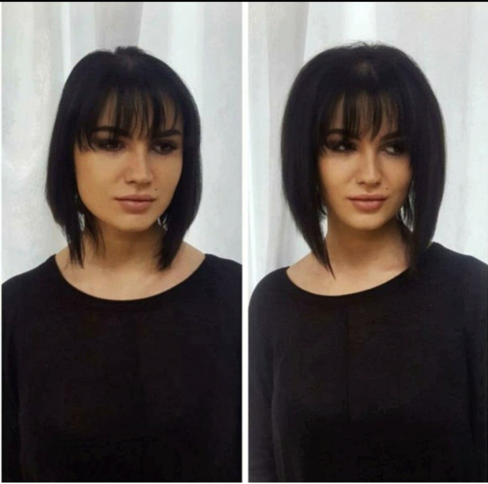 Flasping of the basal volume