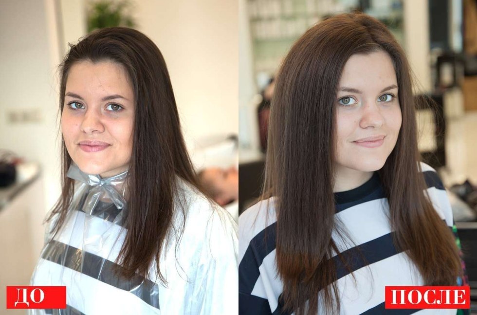 Bouffant Procoronal volume