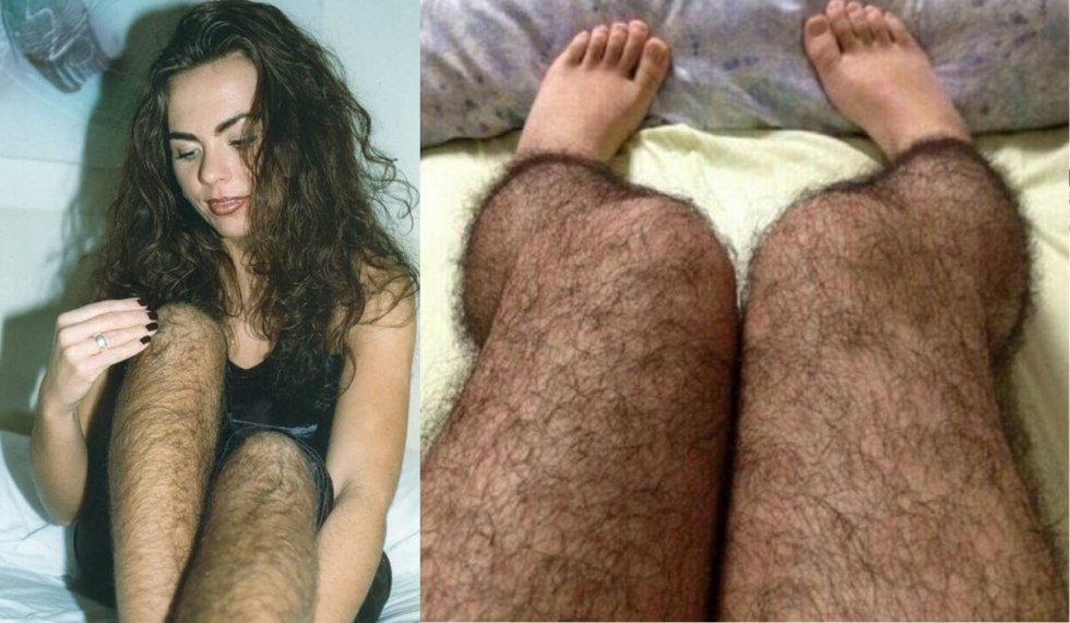 Very hairy girls