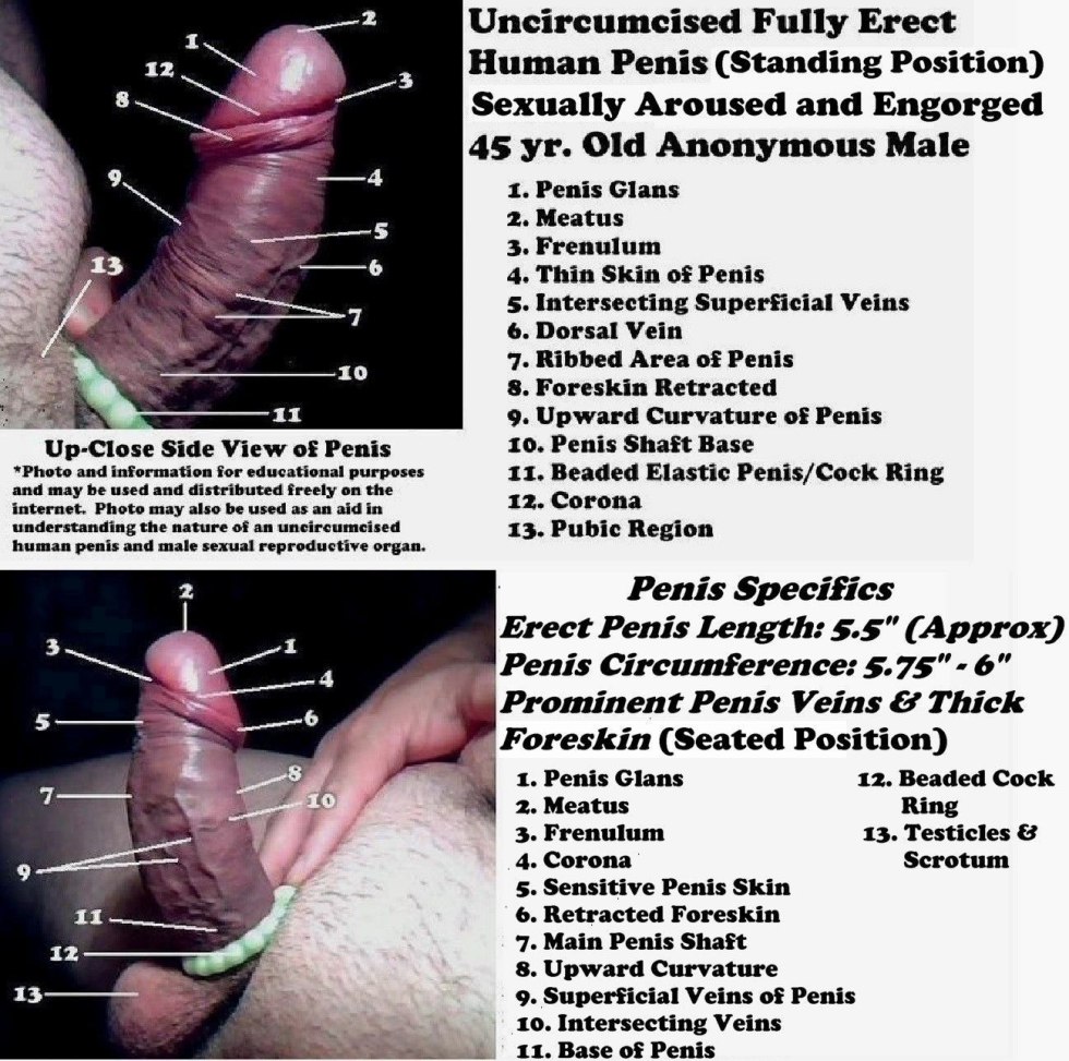 Image of Circumcified vs Uncircumcified Penis