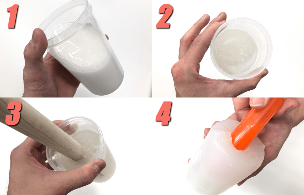 Micoscopic examination smear norm of leukocytes