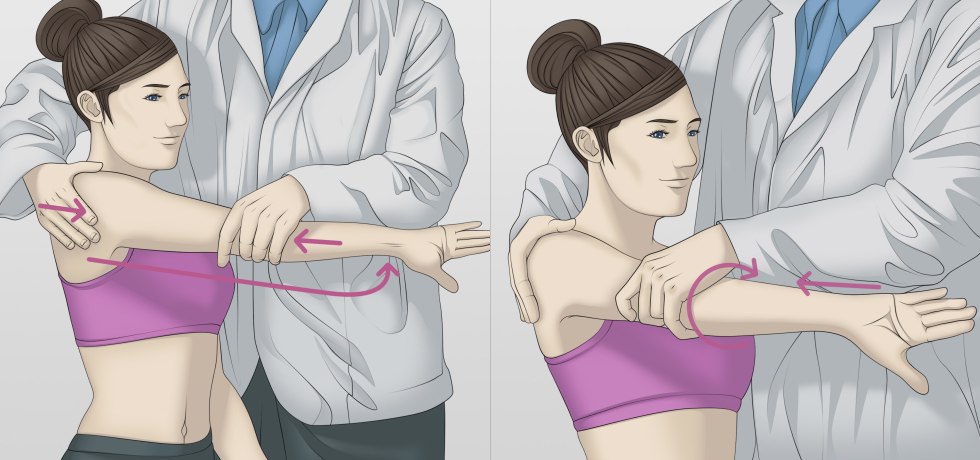 Bilateral orchiectomy