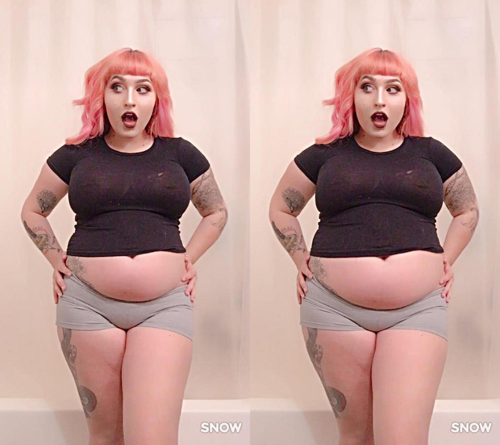 Abdominal type of obesity