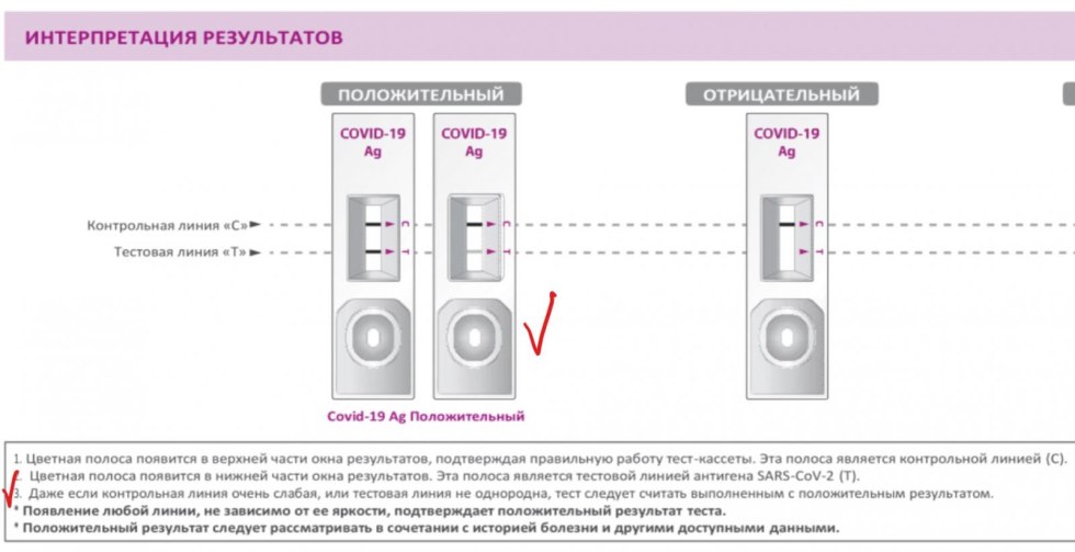 Covid 19 AG Express Test result