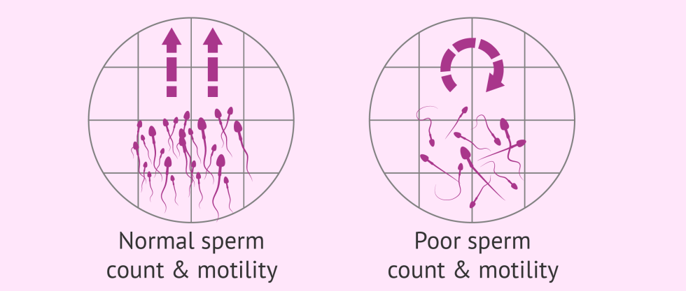 A lot of cum in anal