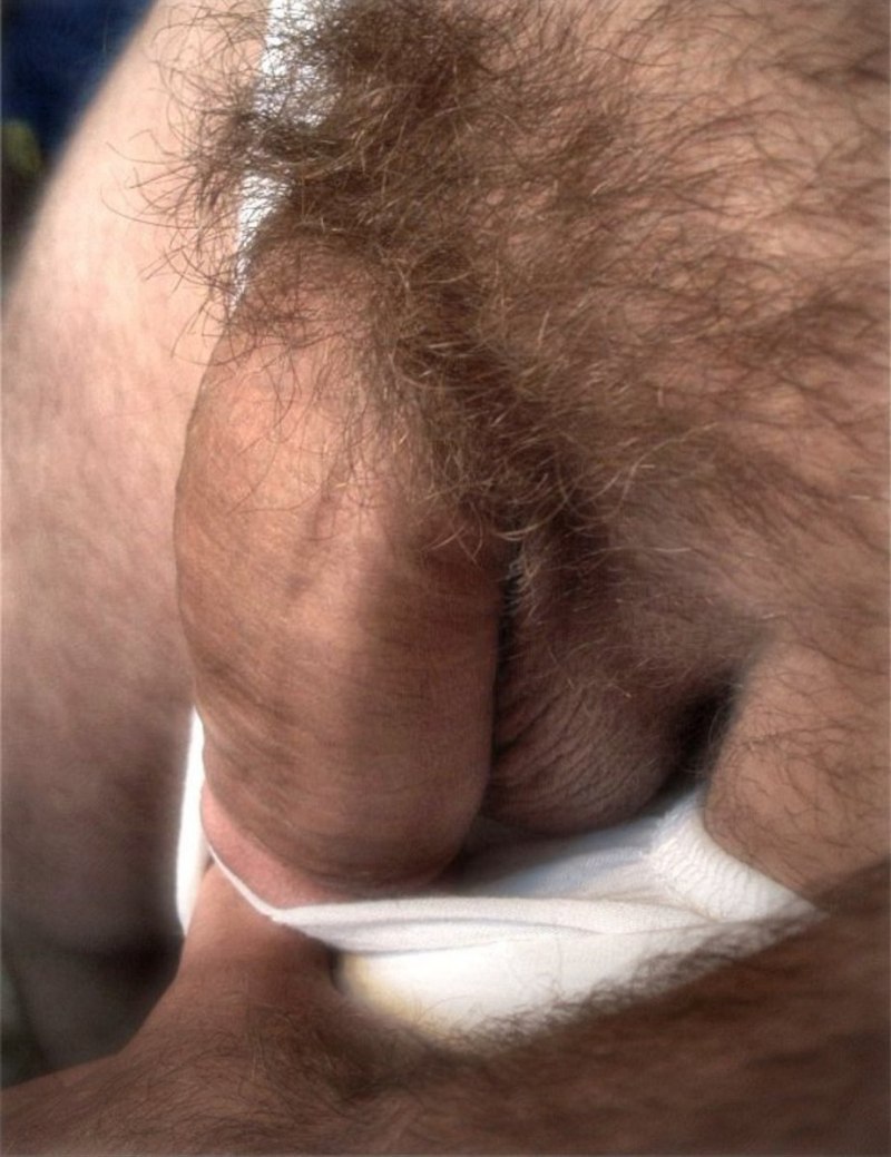Very hairy pubis in women