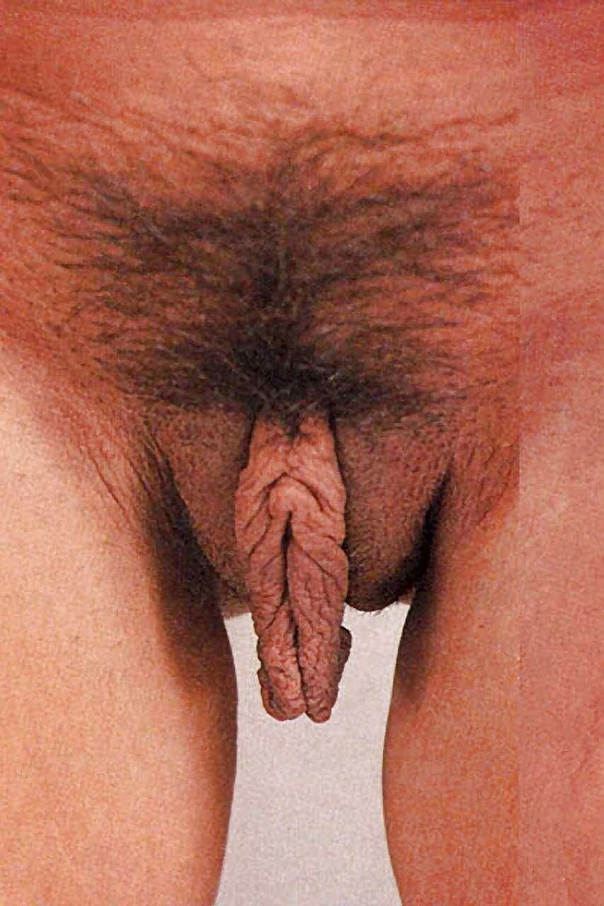 Non -standard genitals