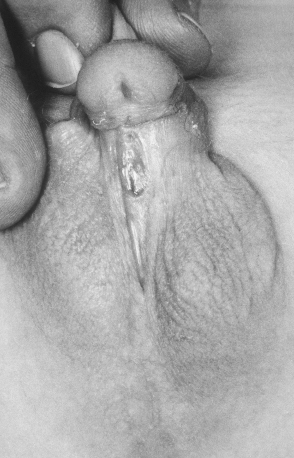 Small/pussy/with large/clitoris