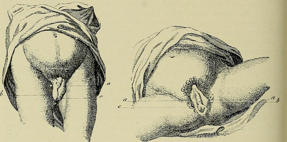 Hermaphroda Hermafrodita, 2009