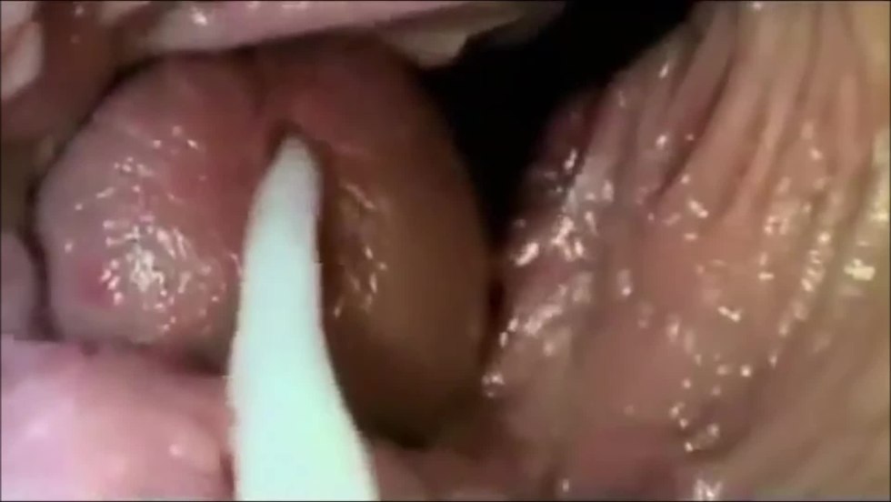 The camera inside the vagina