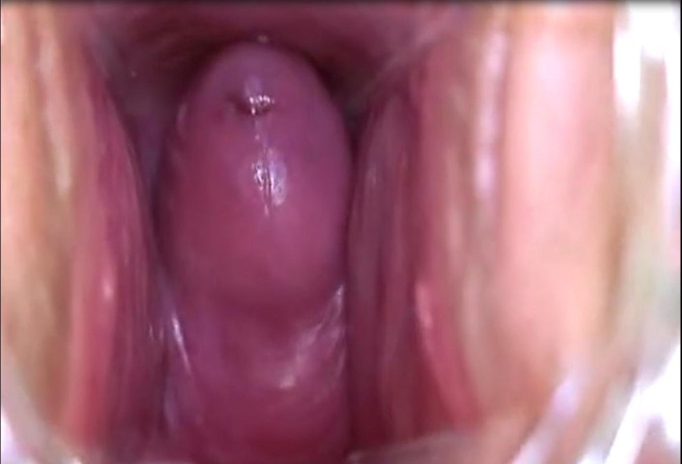 Vagina from the inside in the section
