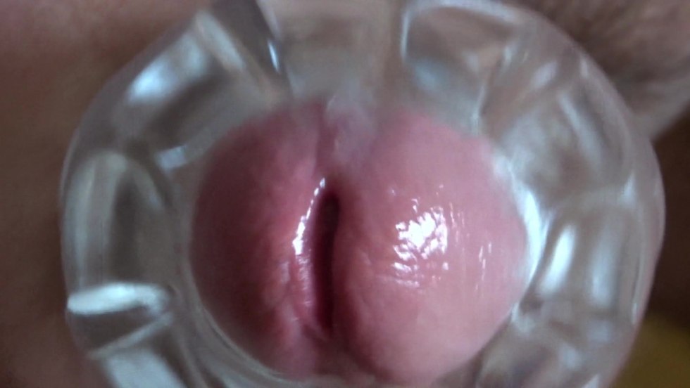 The walls of the vagina from the inside