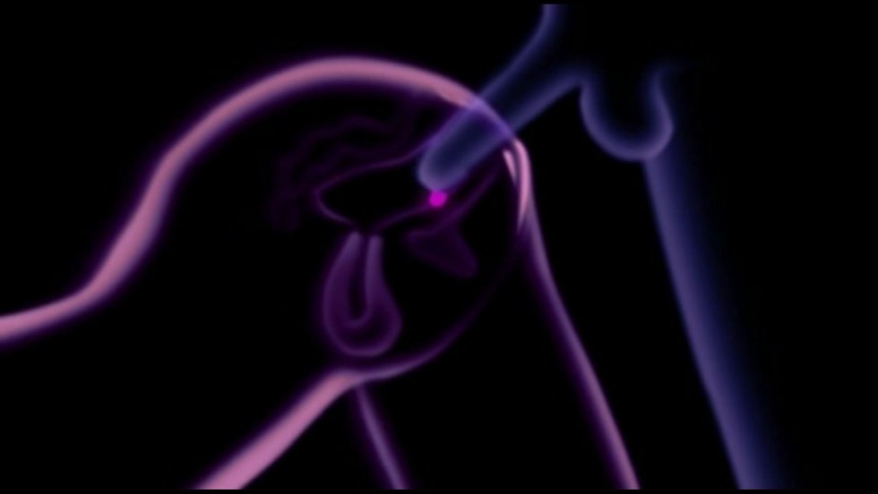 Masturbation of female urethra