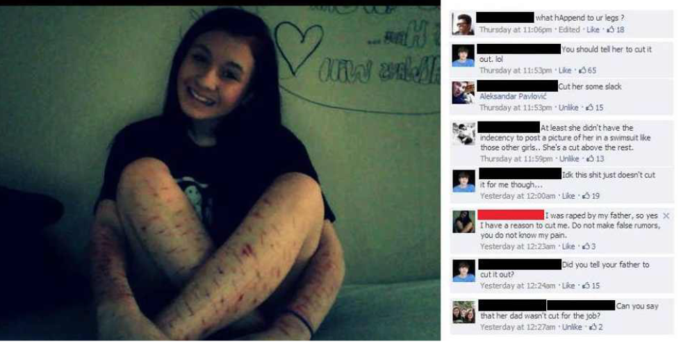 Naked Chinese women with extended legs