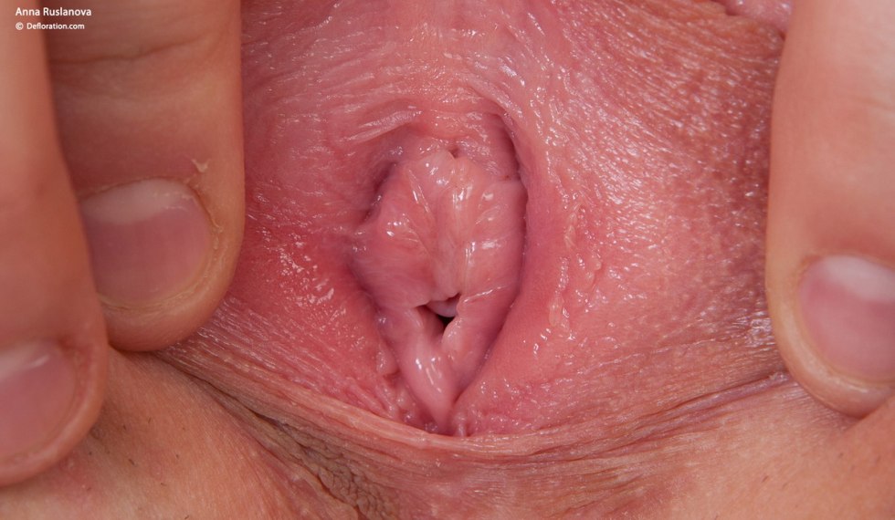 Pubic hair in women