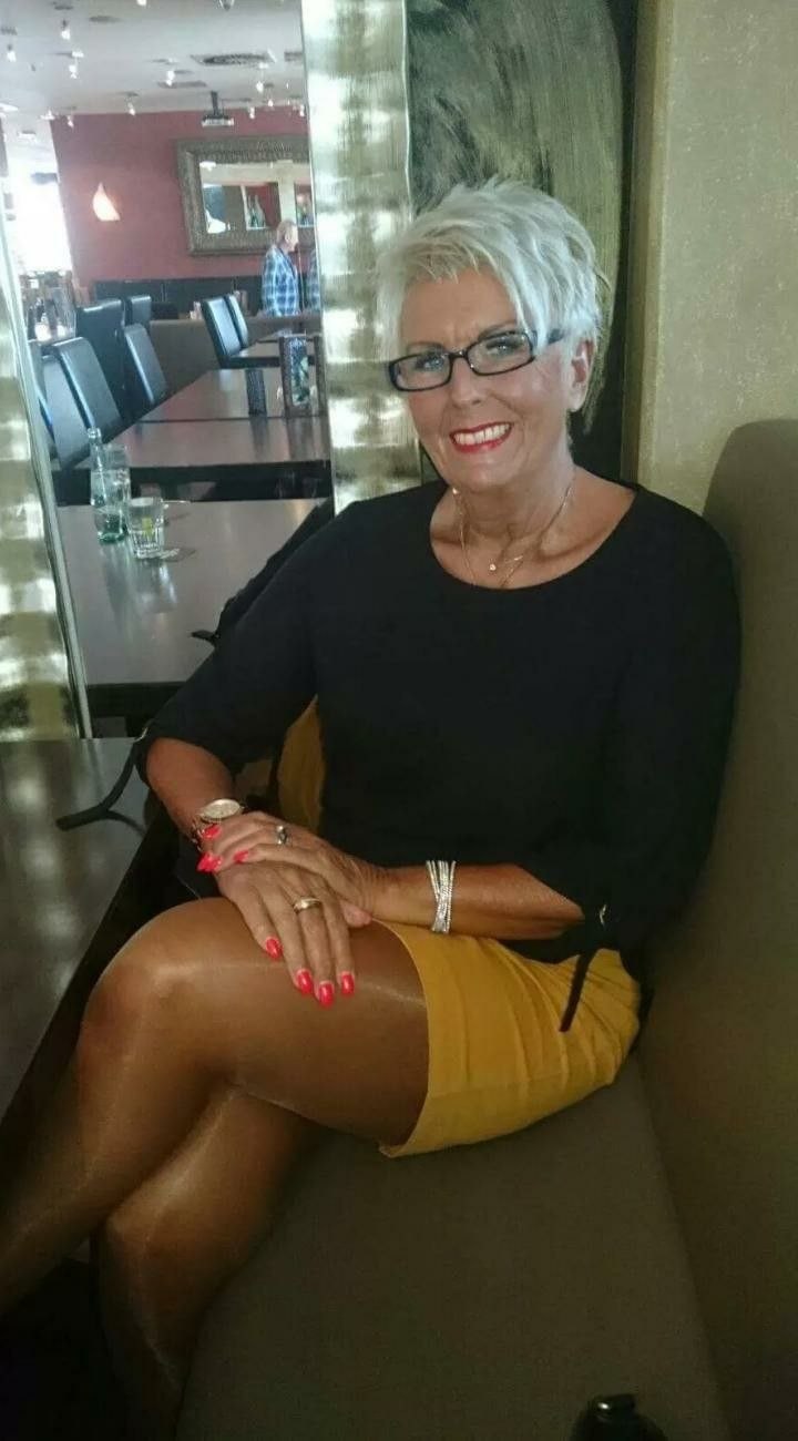 Burned elderly women