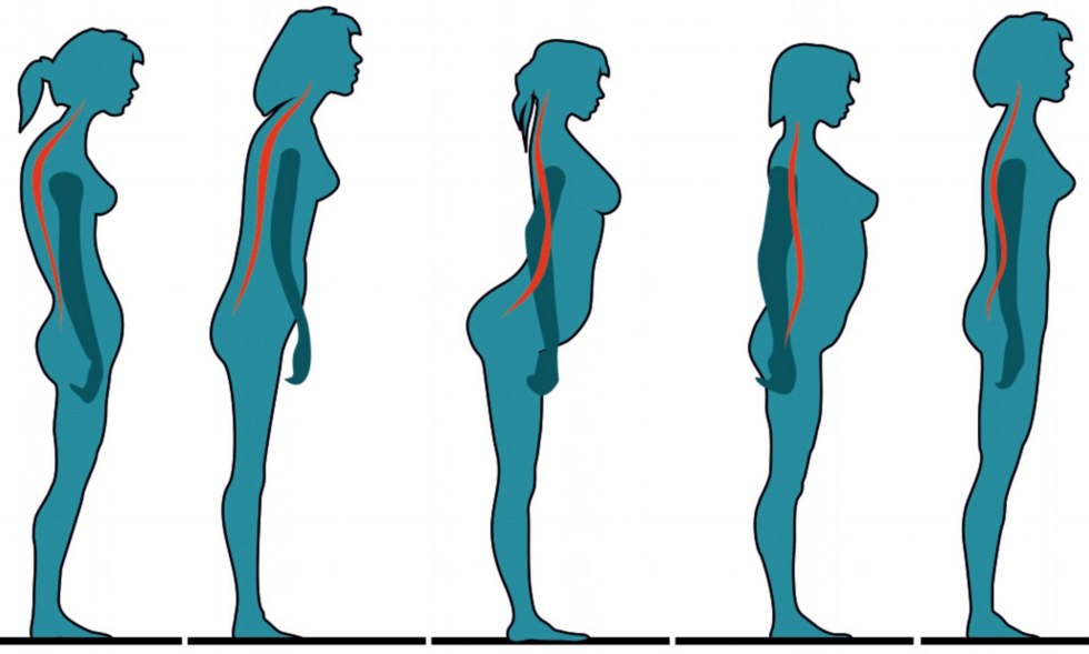 Correct posture and gait