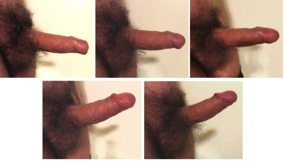 Small penis erection