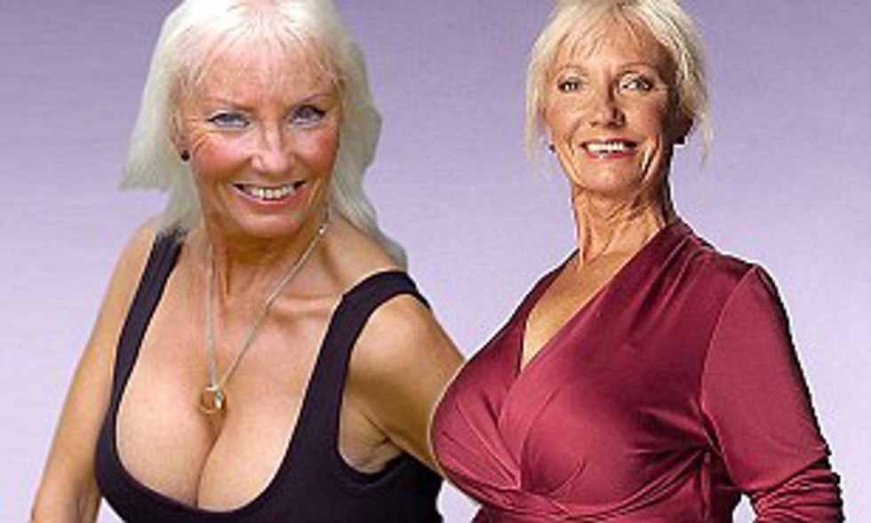 Elderly with beautiful breasts