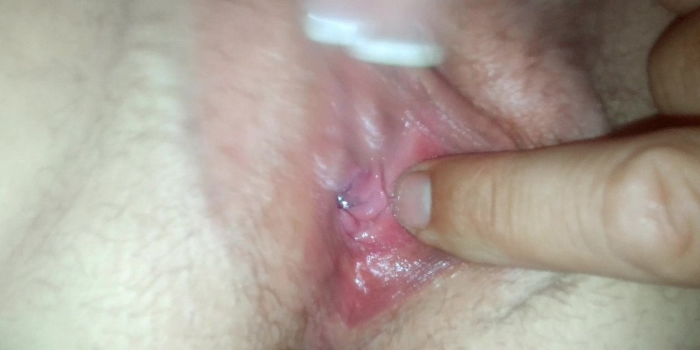 Large labia and clitoris