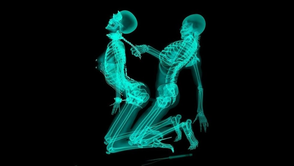 Human X -ray