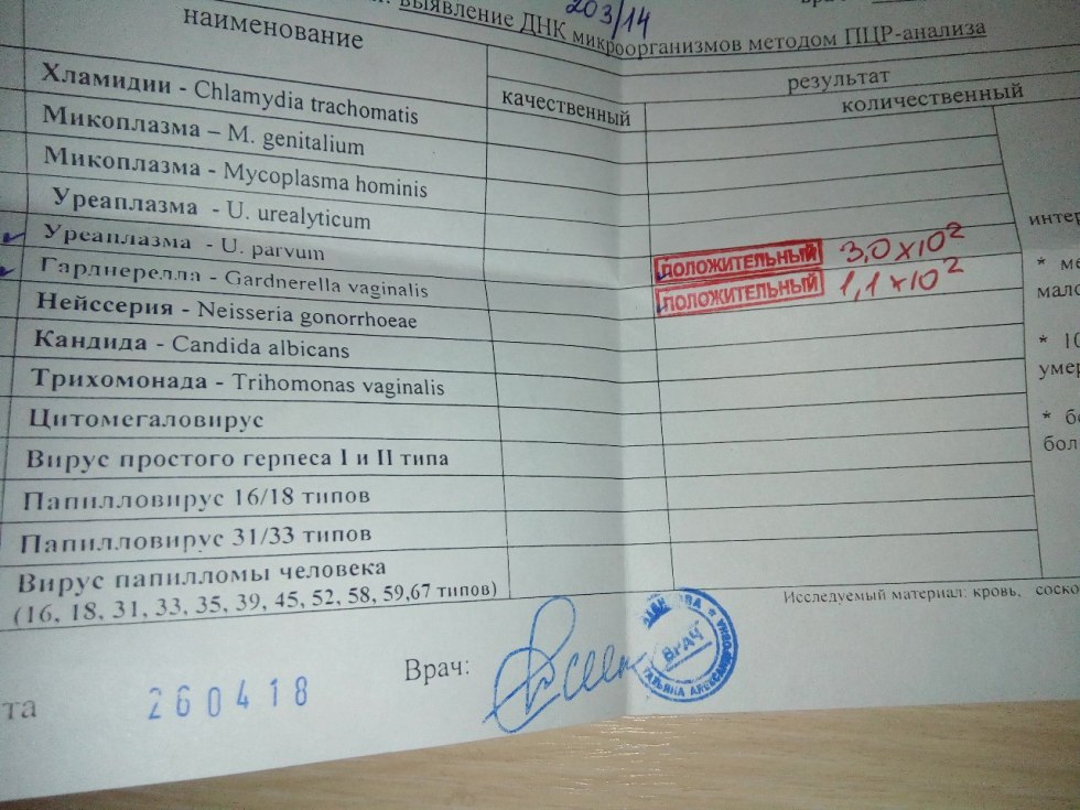 Chlamydia analysis and ureaplasma