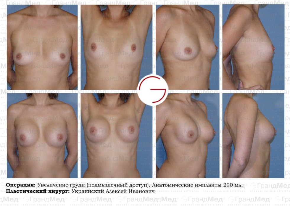 Women's boobs of different sizes