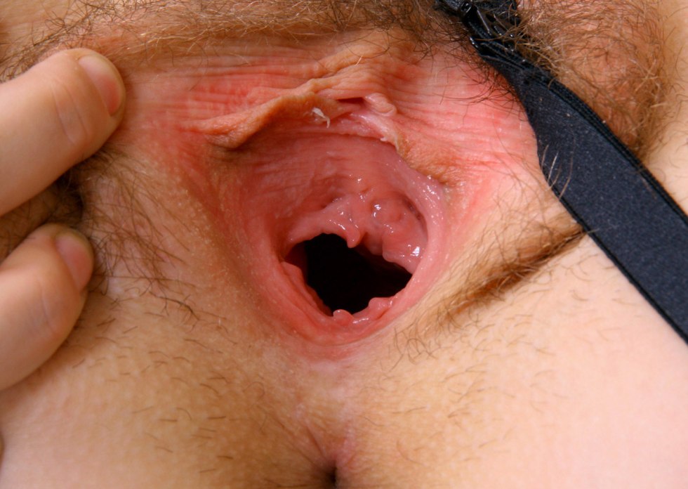 The new vagina of the boy