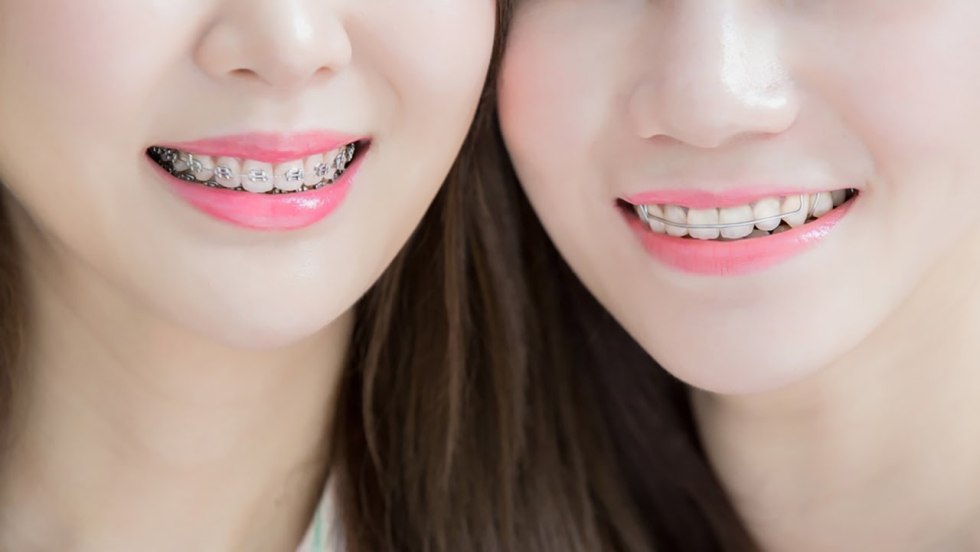 Girls have adolescents on their face