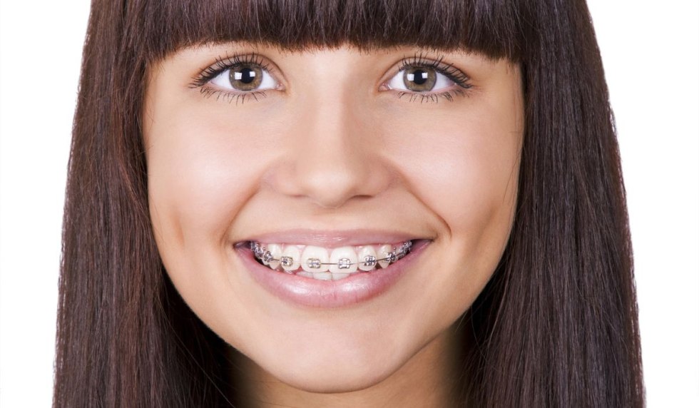 Teeth of a teenager girl
