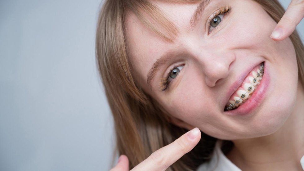 Beautiful teeth with braces girl