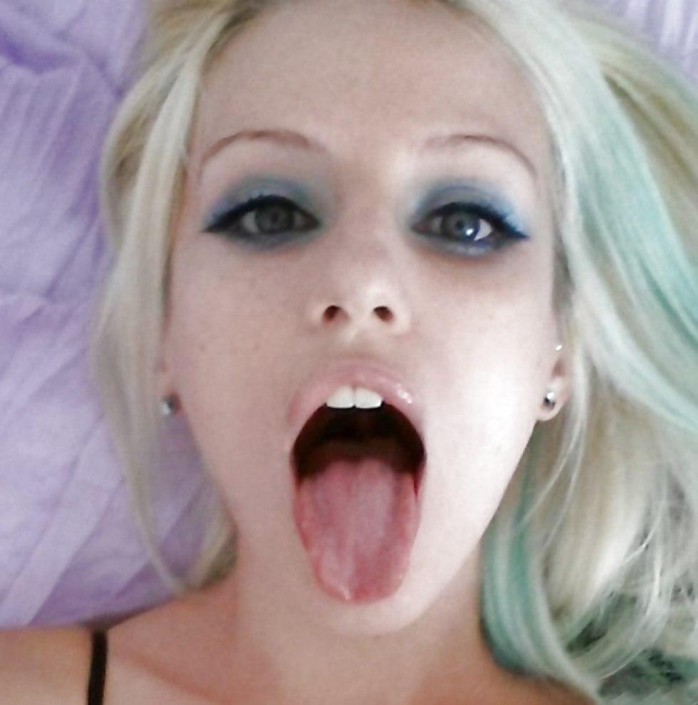 Snow -white smile and braces