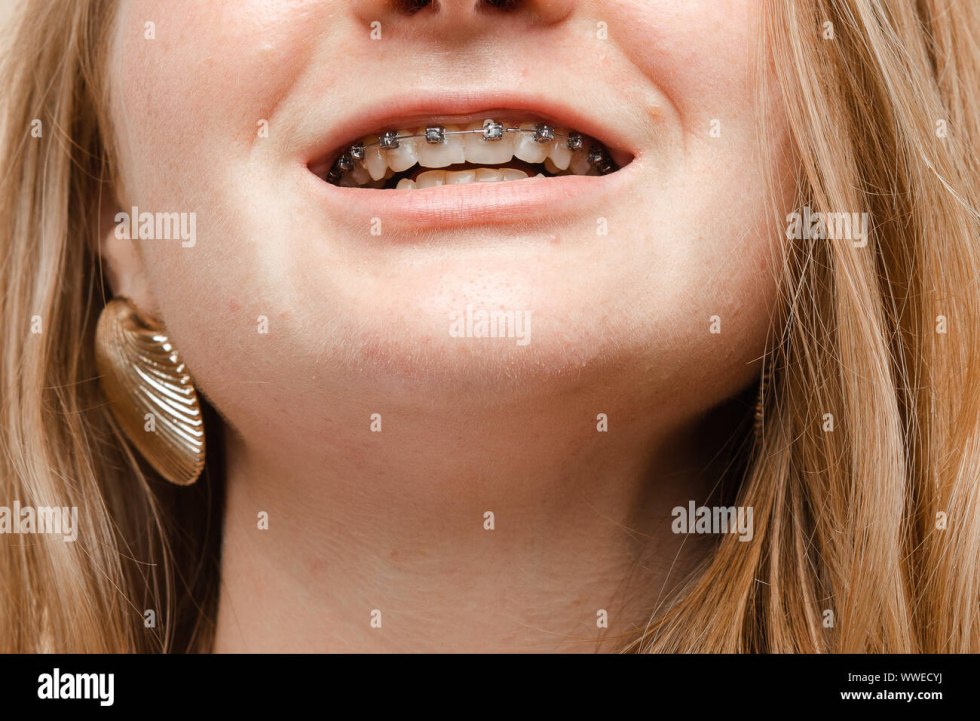 The teen cumshot with braces