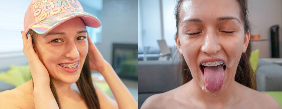 Crooked teeth in children from nipples