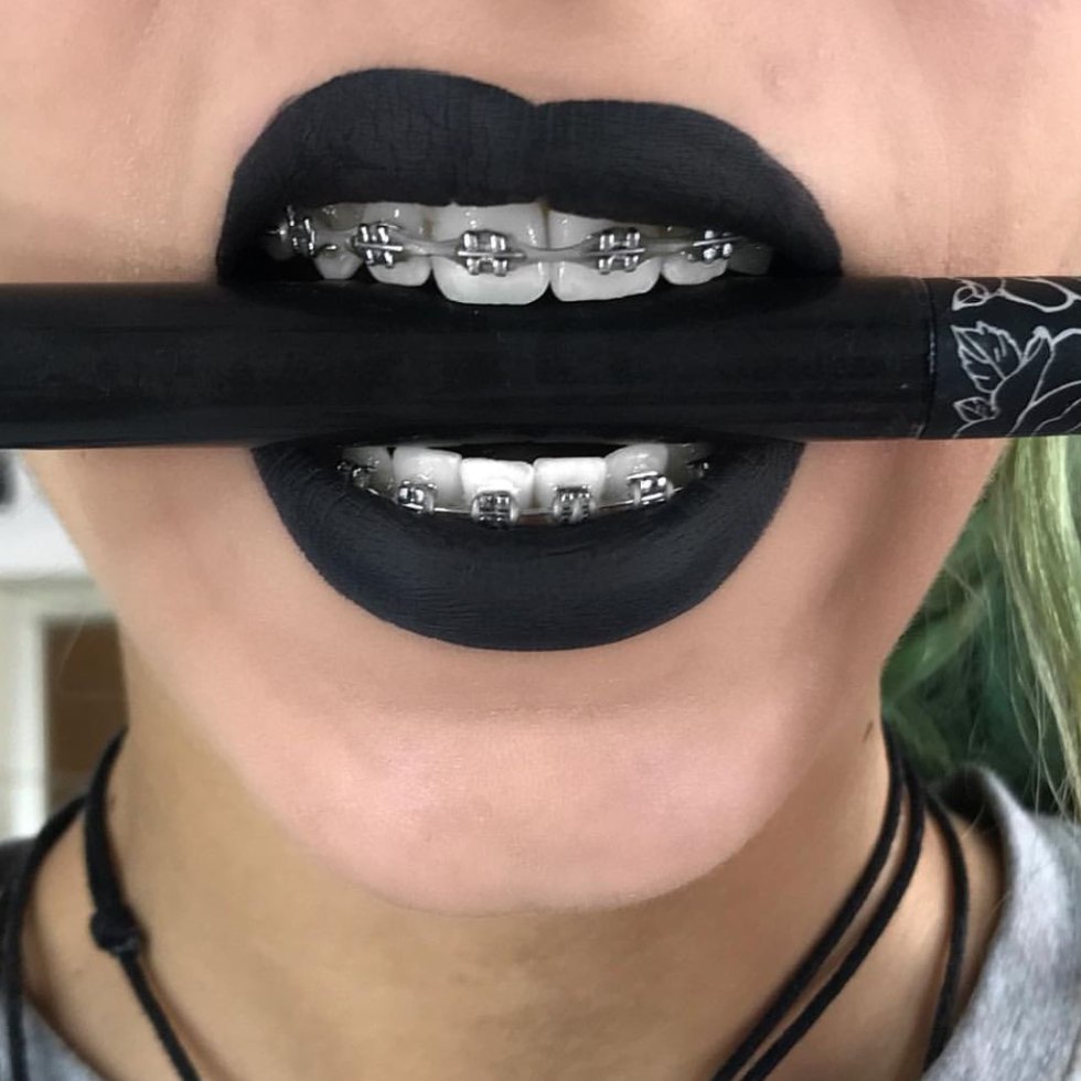 Terrible girl with braces