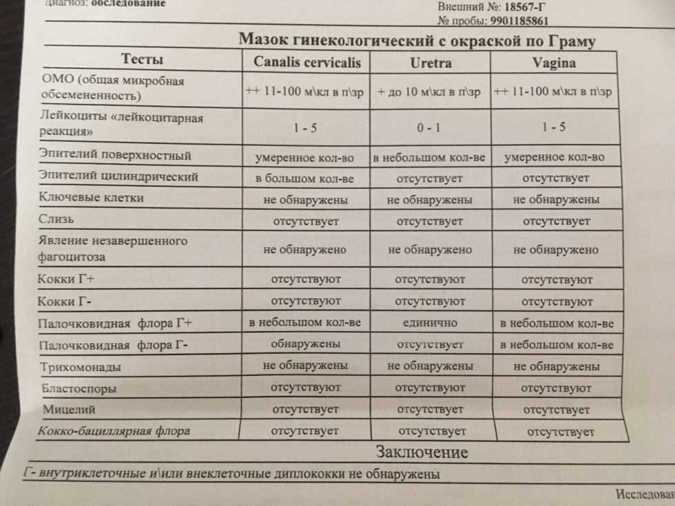 Daewoo Nexia 1.5 exhaust system