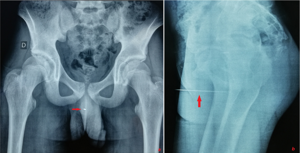 Correct the Mistakes in the Following Sentences