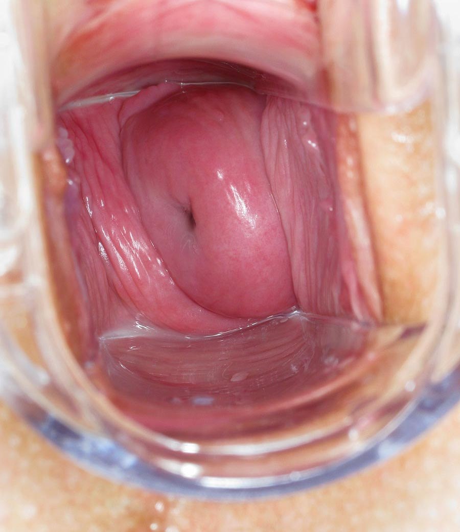 Healthy vagina from the inside