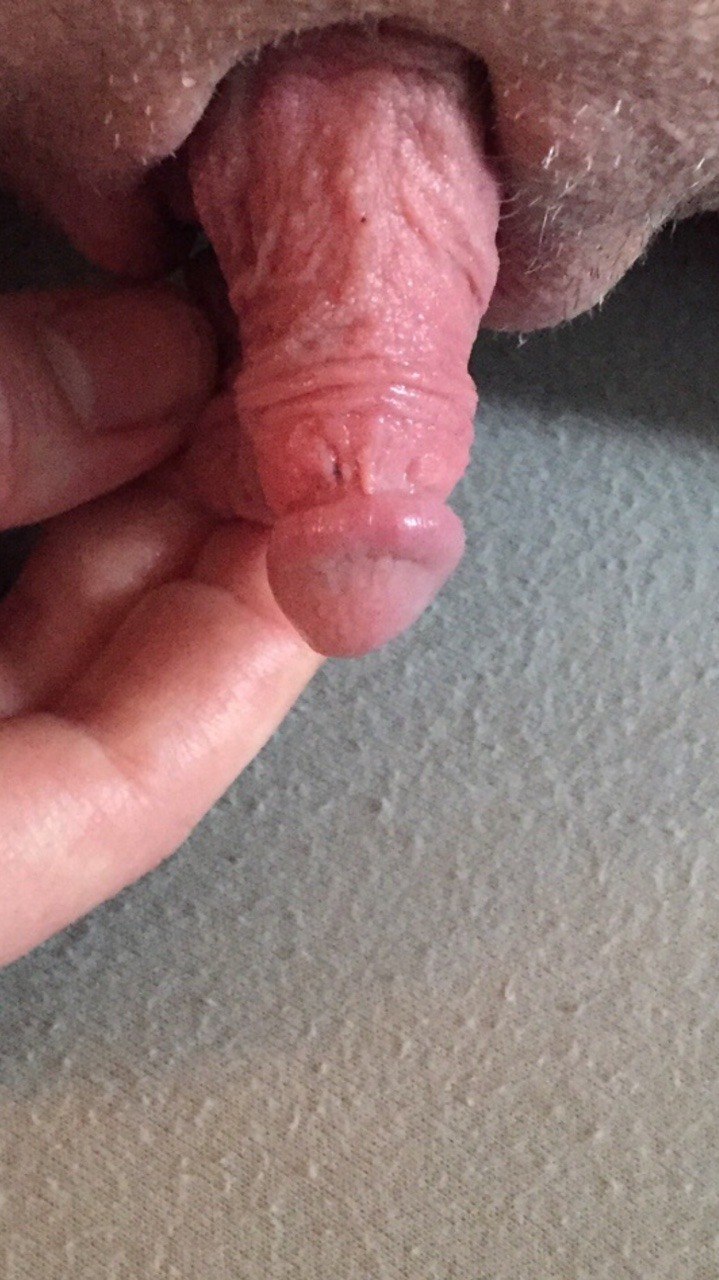 Huge clitoris head