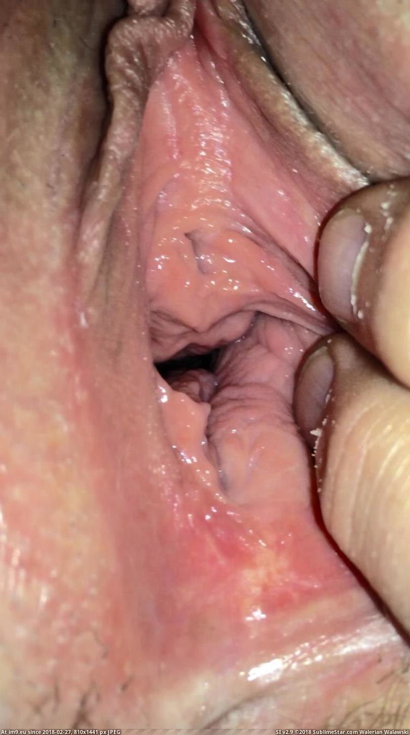 Healthy vagina inside